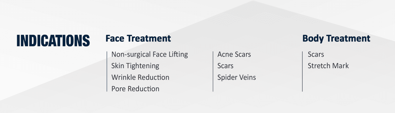 Secret RF - Indications
